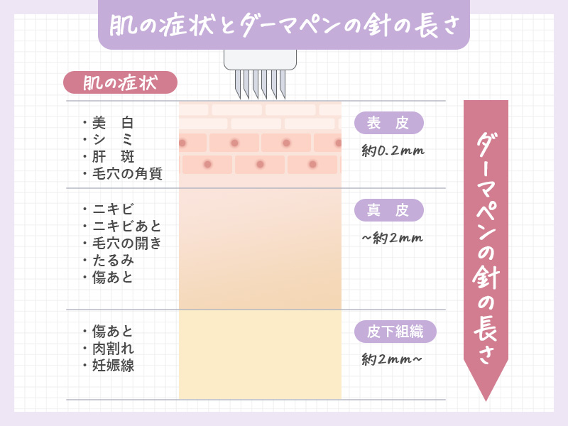 ダーマペンの針の長さを説明した図解