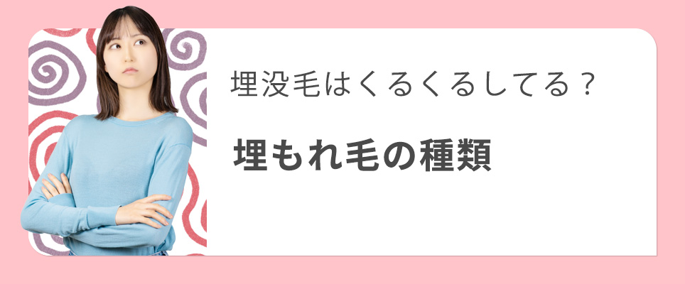 埋没毛・埋もれ毛の種類