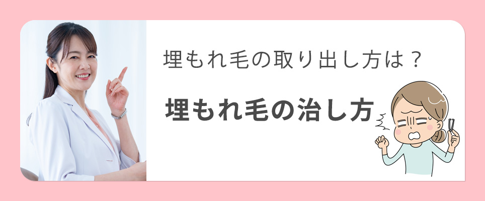 埋没網・埋もれ毛の治し方