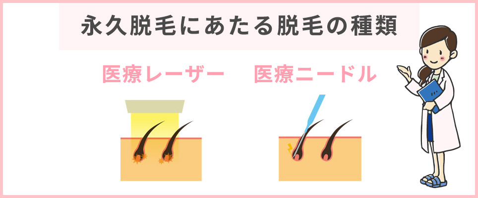 永久脱毛にあたる脱毛の種類