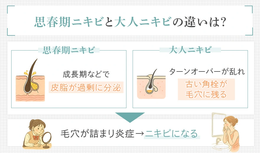 思春期ニキビと大人ニキビの違い
