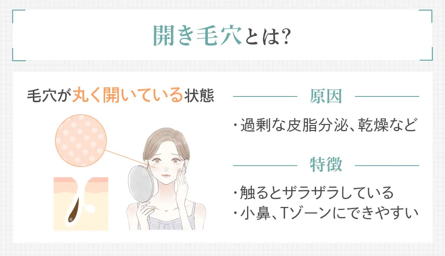 開き毛穴とは