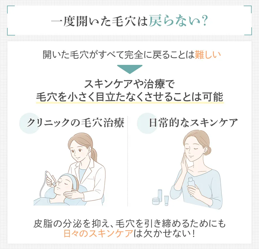 開いた毛穴が戻らない理由