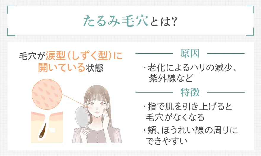 たるみ毛穴とは