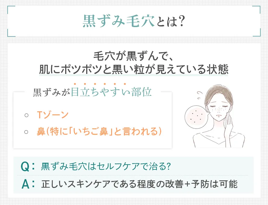 黒ずみ毛穴とは