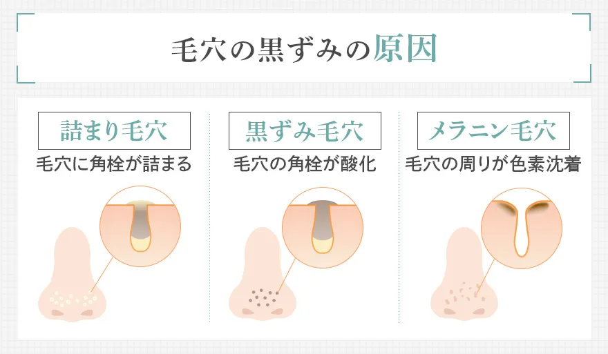 毛穴に黒ずみができる原因