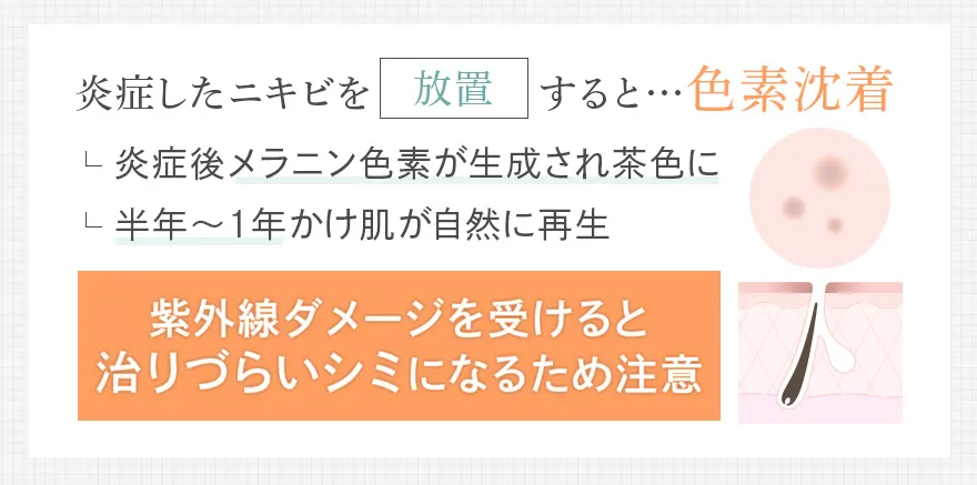 色素沈着したニキビ